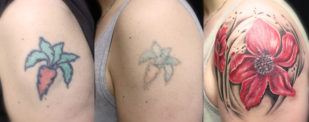 Cover-Up Aufhellung Blume