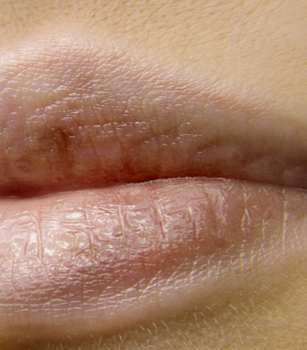 Entfernung Permanent MakeUp Lippen