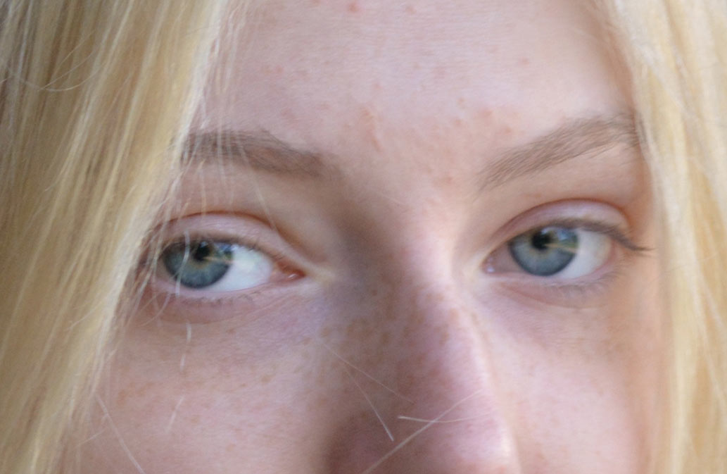 Laserentfernung Permanent MakeUp Nachher