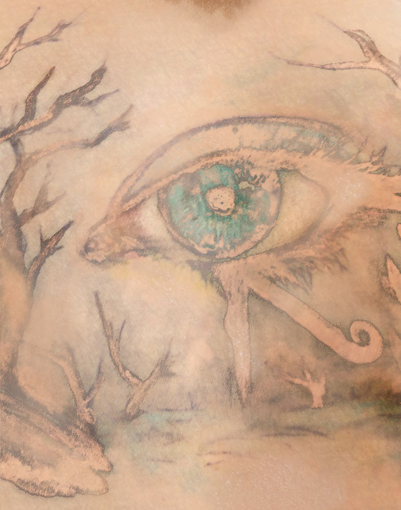 Entfernung buntes Tattoo nach wenigen Sitzungen